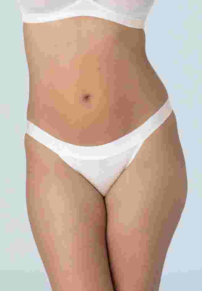 The Cheeky Bikini - Modal image number 0