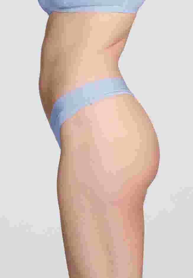 The Thong - Modal image number 2